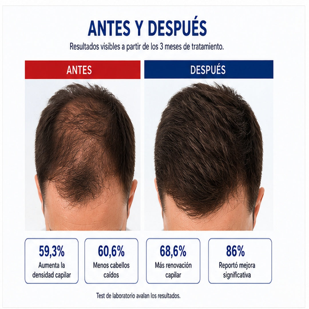 Calvistop Tónico Anti-Caída
